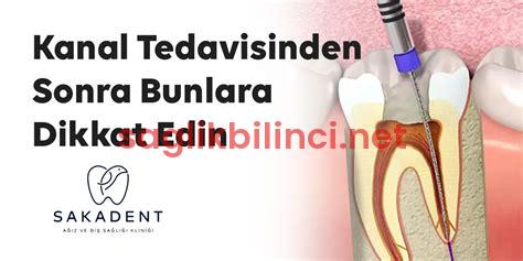 Kanal Tedavisi Sonrası: Dikkat Edilmesi Gerekenler