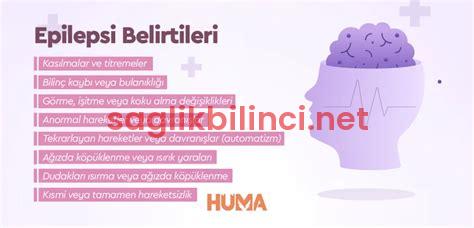 Psikolojik Epilepsi Belirtileri: Tanı ve Yönetim