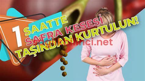 Safra Kesesi Ameliyatı Olanların Deneyimleri ve Yorumları