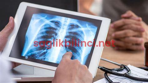 Akciğerimde 7 mm Nodül Var Korkuyorum: Ne Yapmalıyım?