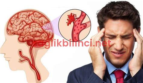 Beyin Kanaması Geçiren Hasta Ne Kadar Yaşar? Gerçekler ve Mitler