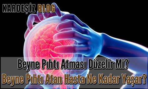 Beyne Pıhtı Atan Hasta Ne Kadar Yaşar? Tıbbi İnceleme