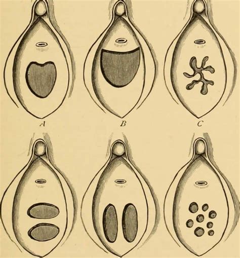 Bozulmuş Kızlık Zarı Belirtileri: Neler Olabilir?