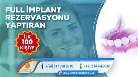 Diş İmplant Fiyatları: 2023 İçin Bilgilendirici Rehber