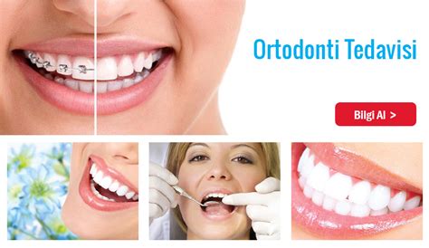 Diş Teli: Faydaları ve Ücretleri