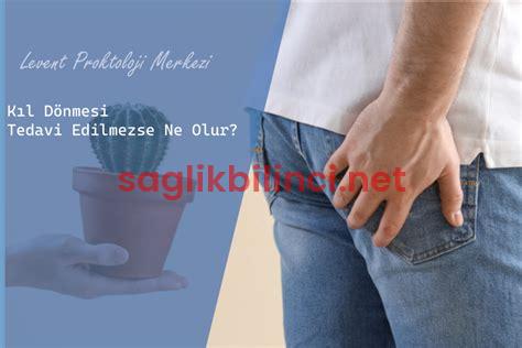 Fissür Tedavi Edilmezse Ne Olur? Riskler ve Çözümler