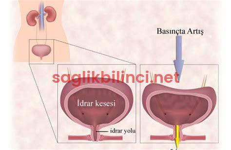 Kadın İdrar Deliği Resmi: Anatomik Bilgiler ve Sağlık Üzerine