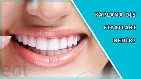 Kaplama Diş Fiyatları: İhtiyaç Duyduğunuz Bilgiler