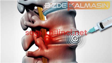 Kasık Fıtığı Ameliyatı Olanların Yorumları: Deneyimler ve Tavsiyeler