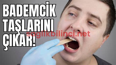 Sonda Nasıl Çıkarılır? Adım Adım Rehber