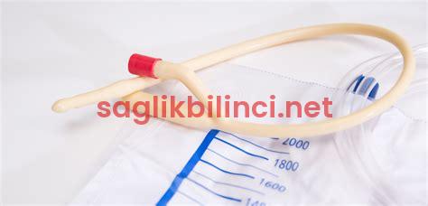 Sonda Takma Yöntemleri: Dikkat Edilmesi Gerekenler