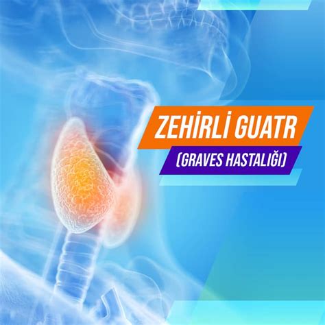 Zehirli Guatr: Belirtileri ve Tedavi Seçenekleri